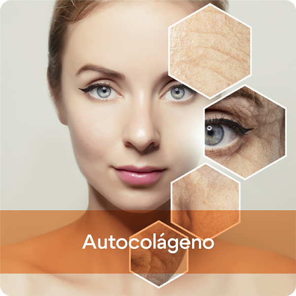 Autocolágeno