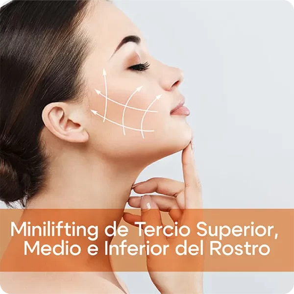 Minilifting de Tercio Superior, Medio e Inferior del Rostro