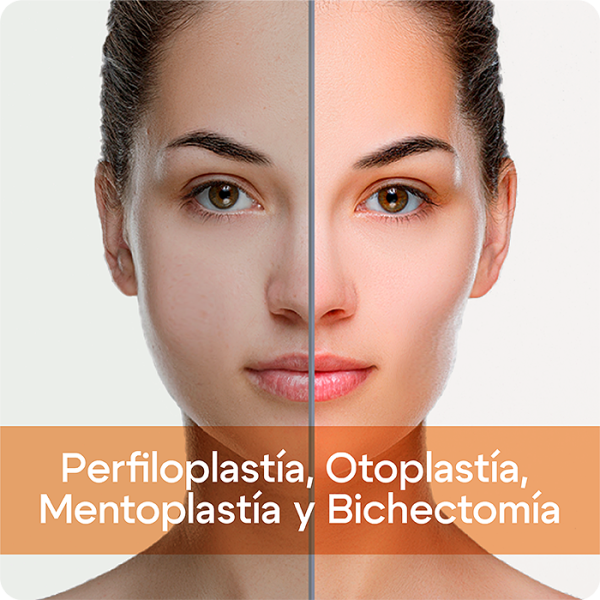 Perfiloplastía, Otoplastía, Mentoplastía y Bichectomía