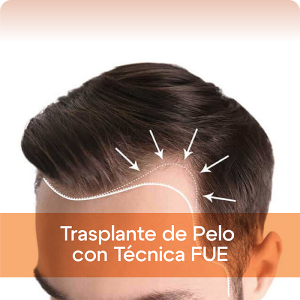 Trasplante de Pelo con Técnica FUE