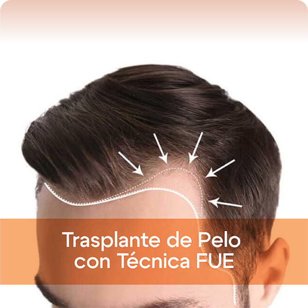 Trasplante de Pelo con Técnica FUE